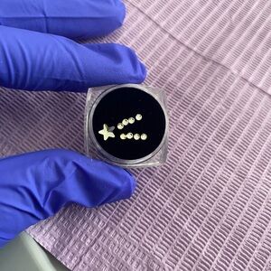 Shooting Star Tooth Gem Tech Check